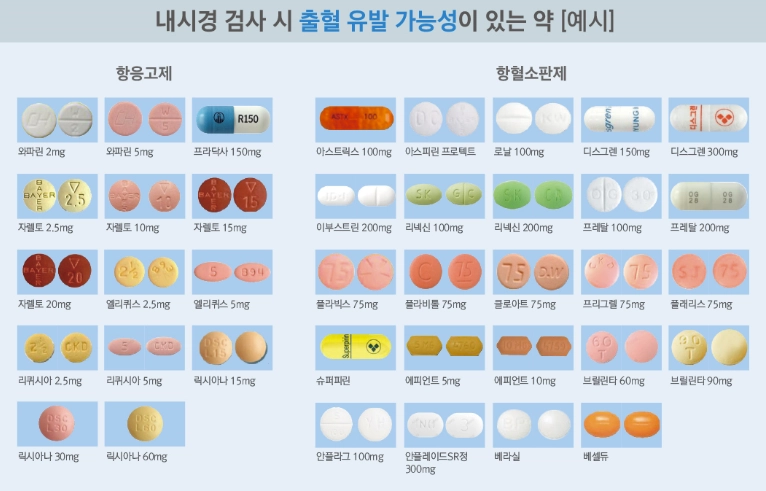 내시경 검사 시 출혈 유발 가능성 있는 약